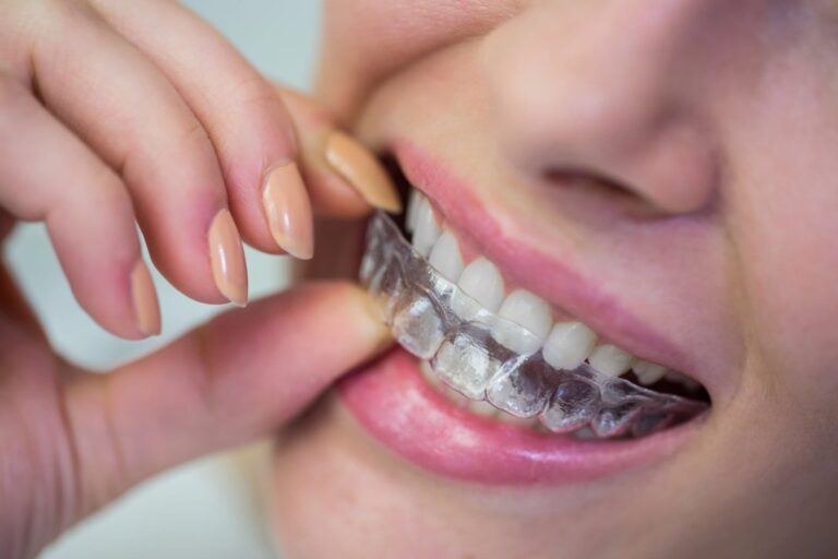 Young woman smiling and inserting her clear Prezurv® retainer