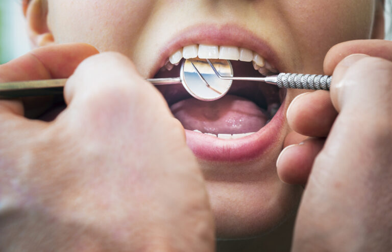 Young woman with a bonded retainer having her retainer maintenanced by her orthodontist