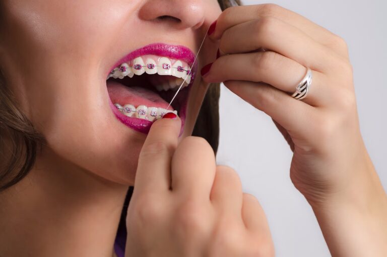 Woman with bright pink braces and pink lipstick flossing her brackets