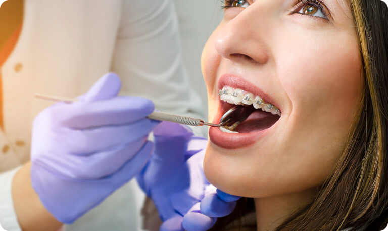 Woman with braces having the back of her teeth examined with a small dental mirror