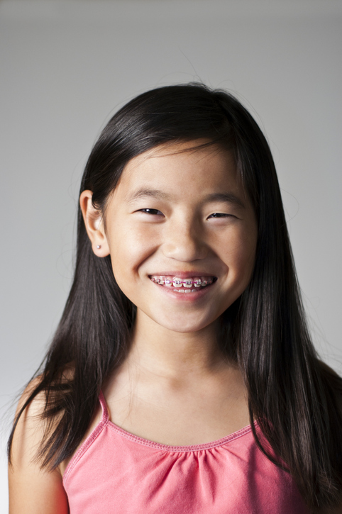 Smiling young girl undergoing early orthodontic treatment with pink braces